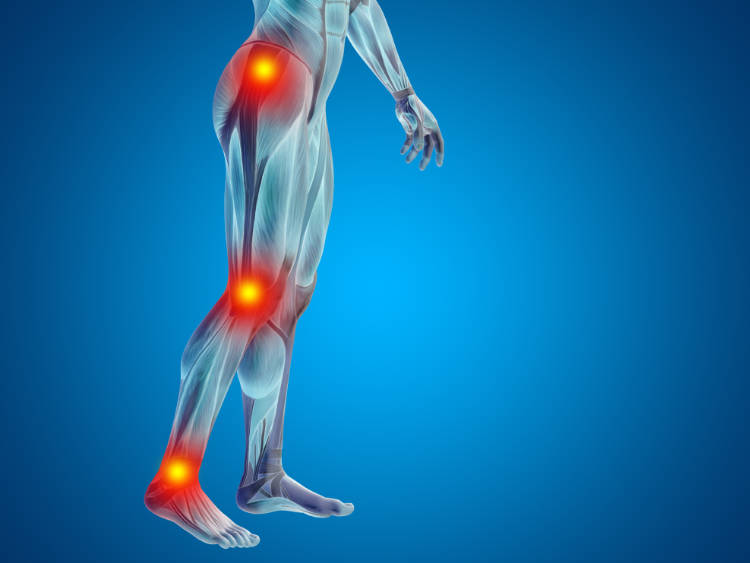 3D illustration of the human form with hip, knee, and ankle joints illuminated to show how an injury in one area can lead to pain in the next.